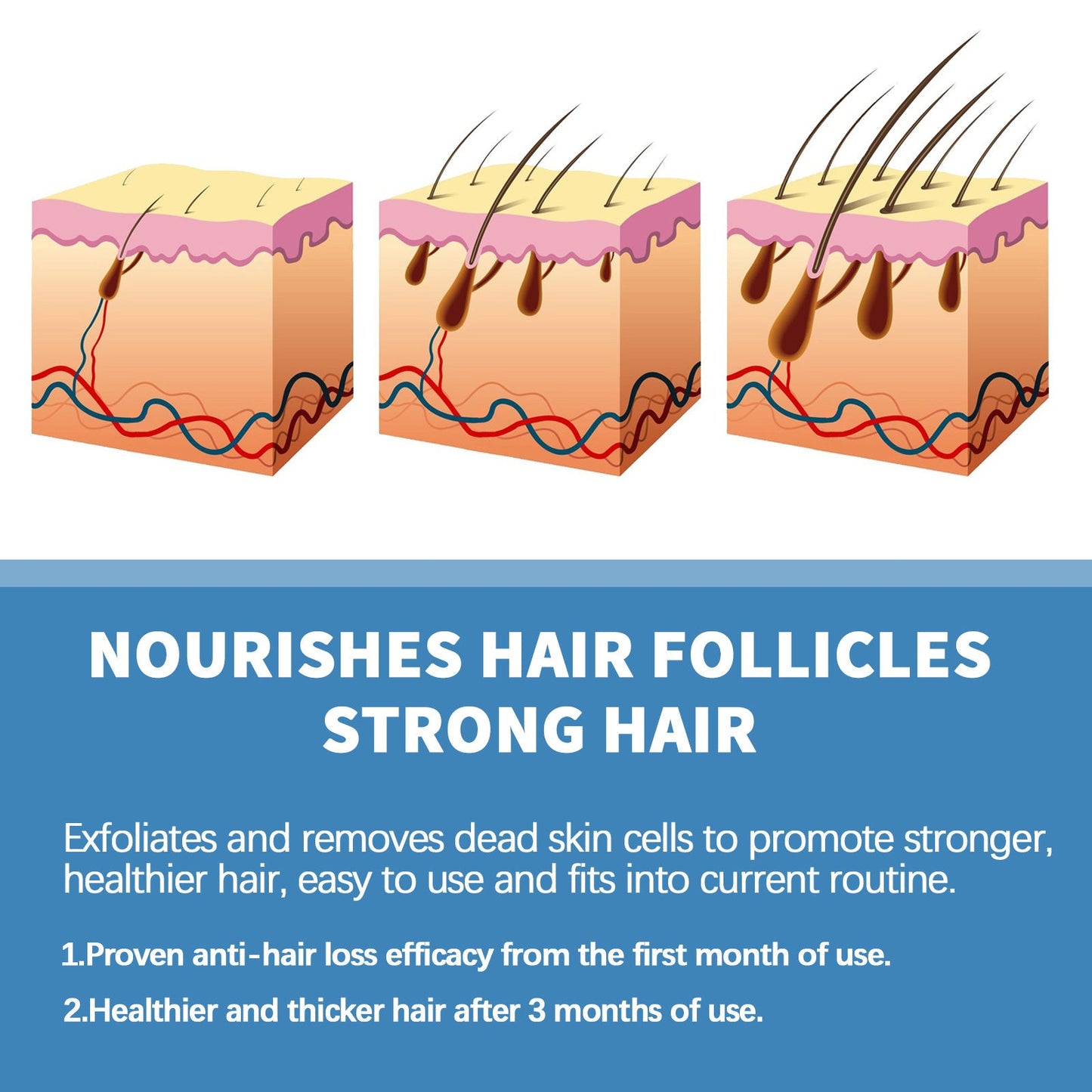 đ„BegrĂ€nsad tid 50 % rabattđżEAST MOON Minoxi Roll-On hĂ„rbehandling