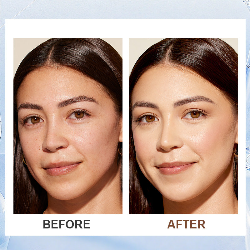 đžAnti-rynk uppstramande ansiktskrĂ€m