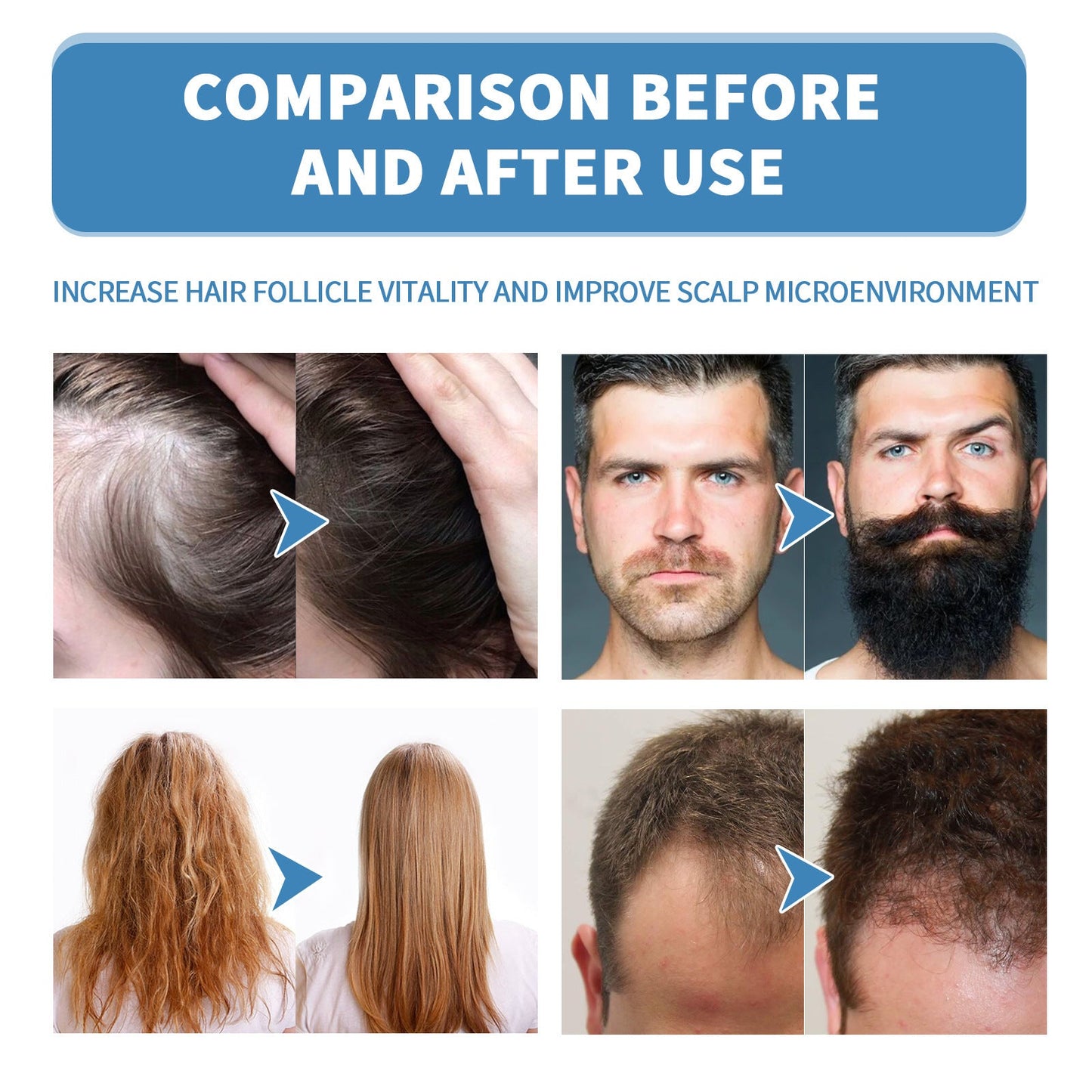 🔥Begränsad tid 50 % rabatt🌿EAST MOON Minoxi Roll-On hårbehandling