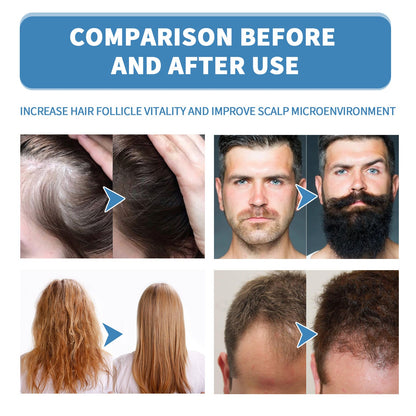 🔥Begränsad tid 50 % rabatt🌿EAST MOON Minoxi Roll-On hårbehandling