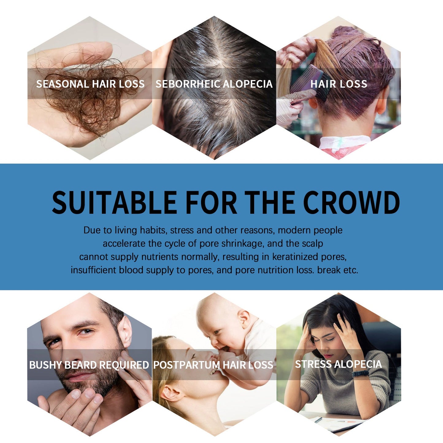 🔥Begränsad tid 50 % rabatt🌿EAST MOON Minoxi Roll-On hårbehandling