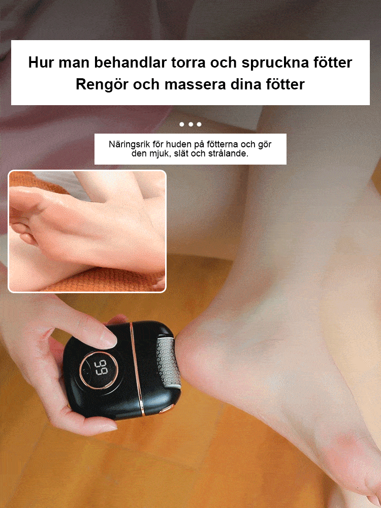 Elektriska förhårdning borttagare för fot