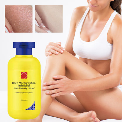 🔥Djup fuktgivande klåda lindring icke-fet lotion💧