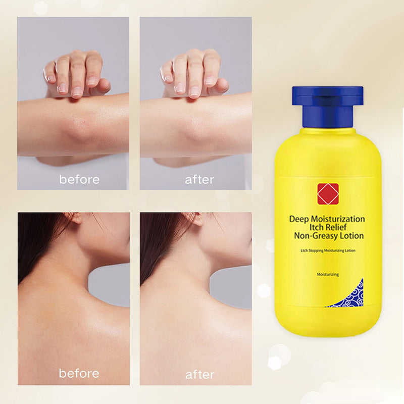 🔥Djup fuktgivande klåda lindring icke-fet lotion💧