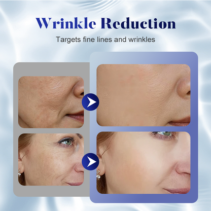 🌸Anti-rynk uppstramande ansiktskräm